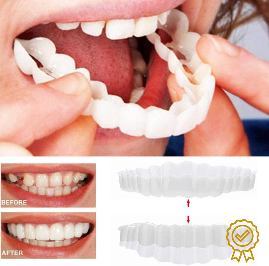 Snap On Smile Veneers